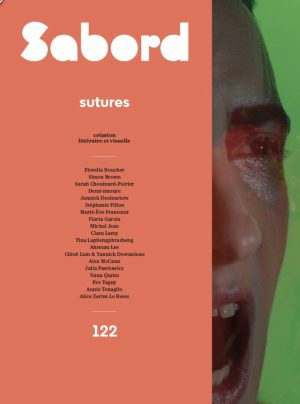 122 • sutures